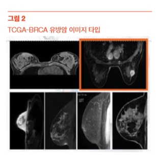 그림2 TCGA-BRCA 유방암 이미지 타입